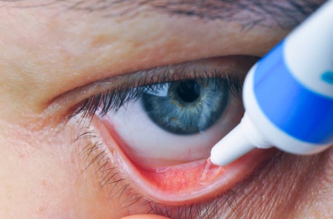 eye_ointment_678x446_compressed